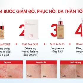 QUY TRÌNH CHĂM SÓC DA DẦU MỤN, NHẠY CẢM