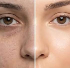 Mở khóa tính năng trị liệu làn da đô thị của FAU Shiny Pumpkin Amino Therapy