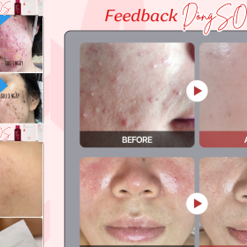 CHỨNG THỰC BẰNG HÌNH ẢNH: “SỨC MẠNH” PHỤC HỒI NHANH CỦA FAU SOS LINE